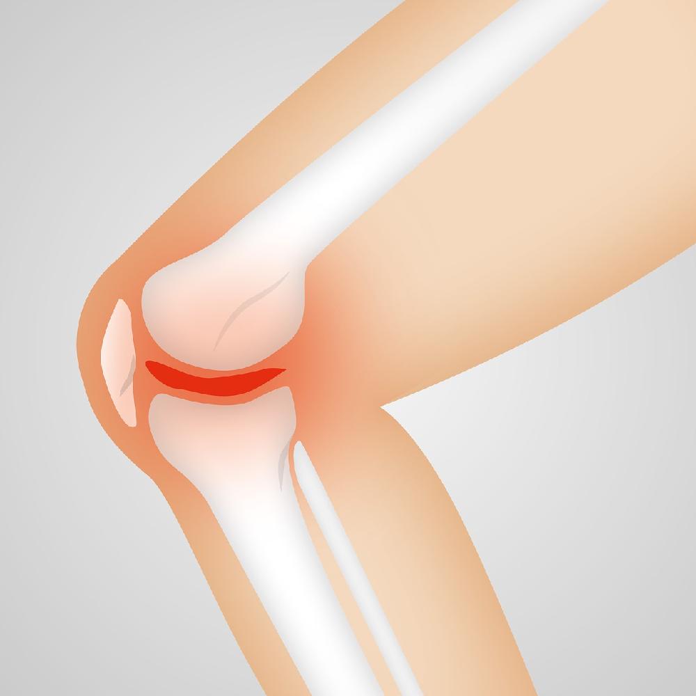 Co warto wiedzieć na temat artroskopii kolana?